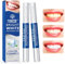 2 Stück Zahnaufhellung Stift, Bleaching Zähne Stift, Zähne Aufhellen Set Effektiv Schnelles Flecken Entfernen, Teeth Whitening Essence Pen, Zahnweiss Bleaching, Zahnbleaching zu Hause
