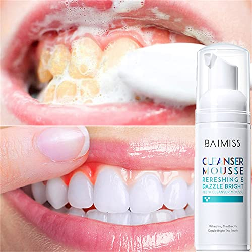 Zahnschaum Erwachsene Reinigung Mousse Zahnpasta Mundhygiene,Tiefenreiniger Zahnpasta Schaum,Schaumzahnpasta Zahnaufheller Entfernt Plaque Flecken für Alle Menschen,Tooth Mousse