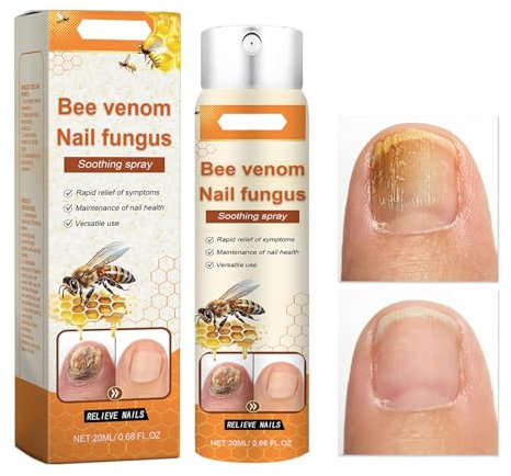 Bee Venom Nail Fungus Soothing Spray for Toenail, Bee Venom Nail Fungal Treatment, Nail Strengthener for Damaged Nails, Bee Venom Nail Treatment Serum, Effective Nail Repair Treatment
