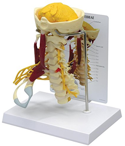 GPI Anatomicals W47853 Halswirbel Muskeln Modell