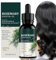 Duqulle Aceite Capilar para Cabello Dañado | Aceite Natural Fortalecedor para Cuero Cabelludo y Cabello de 30ml | Brillo Natural Masaje Capilar Fortalecimiento Puntas Abiertas Todo Tipo