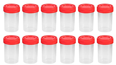 Hemobllo Specimen Cup, 25 Pcs 60ml Sample Cup Urine Container Specimen Collection Cups with Screw-on Lids Sample Collection Bottle for Laboratory (Random Color)