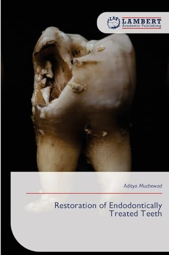Restoration of Endodontically Treated Teeth: DE