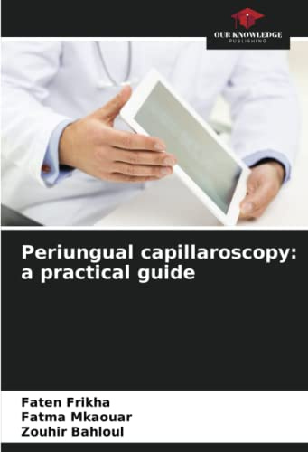 Periungual capillaroscopy: a practical guide