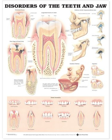 Englisches Poster „Disorders of the Teeth and Jaw“