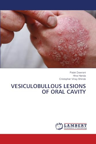VESICULOBULLOUS LESIONS OF ORAL CAVITY: DE