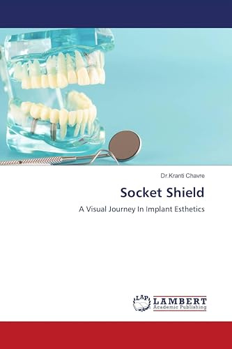 Socket Shield: A Visual Journey In Implant Esthetics