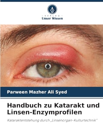 Handbuch zu Katarakt und Linsen-Enzymprofilen: Kataraktentstehung durch „Linsenorgan-Kulturtechnik”