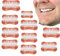 Générique Dentaires Instantanées Placage Prothèse Cosmétique Prothèses Dentier Provisoire Dents Facettes Dentaires Haut Bas Prothèses Dentaires,10pcs