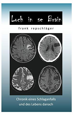 Loch in se Brain: Chronik eines Schlaganfalls und des Lebens danach