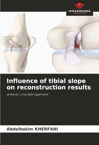 Influence of tibial slope on reconstruction results: anterior cruciate ligament