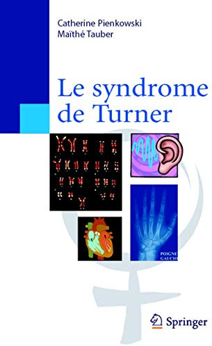 Le Syndrome De Turner