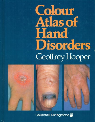 Colour Atlas of Hand Disorders
