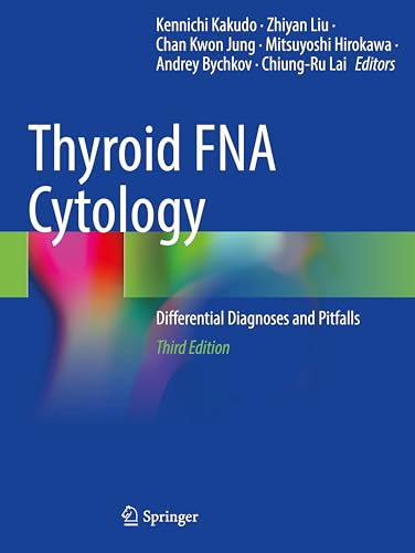 Thyroid FNA Cytology: Differential Diagnoses and Pitfalls