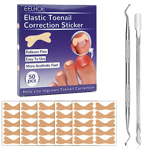 50 Stück Zehennagel Korrekturpflaster, Selbstklebendes Pflaster Für Eingewachsene Zehennägel Mit 2 Zehennagelkorrektur-Pediküre- Werkzeugen, für Paronychie Eingewachsene Fußnägel
