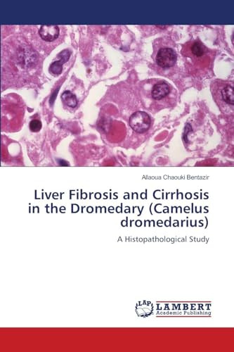 Liver Fibrosis and Cirrhosis in the Dromedary (Camelus dromedarius): A Histopathological Study