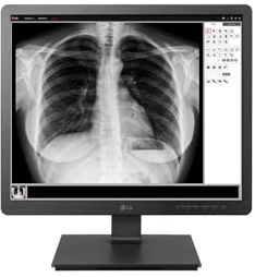 LG 19HK312C-B Pantalla para PC 48,3 cm (19) SXGA Plana Negro - Monitor (48,3 cm (19), 1280 x 1024 Pixeles, SXGA, 14 ms, Negro)