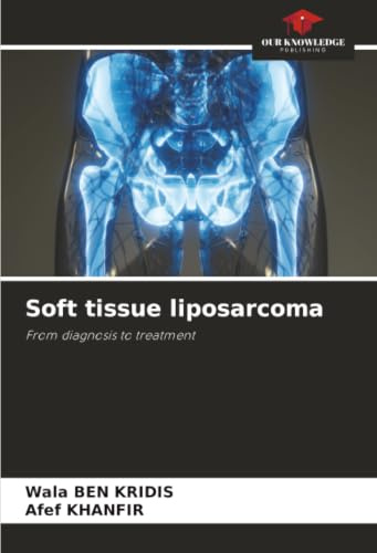 Soft tissue liposarcoma: From diagnosis to treatment