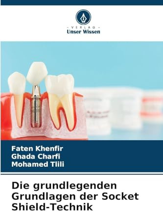 Die grundlegenden Grundlagen der Socket Shield-Technik