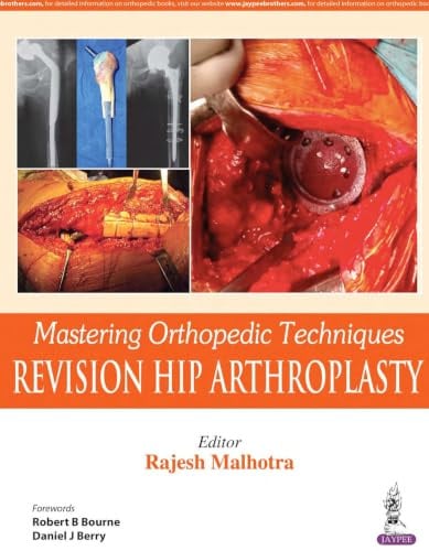 Mastering Orthopedic Techniques: Revision Hip Arthroplasty
