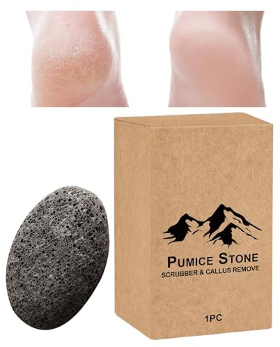 Pumice Stone – Natural Double-Sided Portable Foot Scrub Care Tool For Dry Rough Cracked Skin Shower Spa Manicure Travel Use