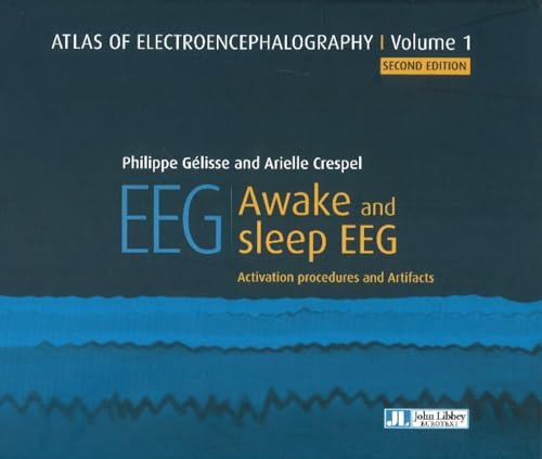 Atlas of Electroencephalography: Awake and sleep EEG