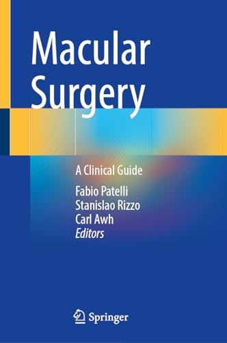 Macular Surgery: A Clinical Guide