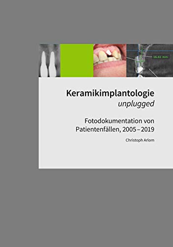 Keramikimplantologie unplugged: Fotodokumentation von Patientenfällen, 2005-2019