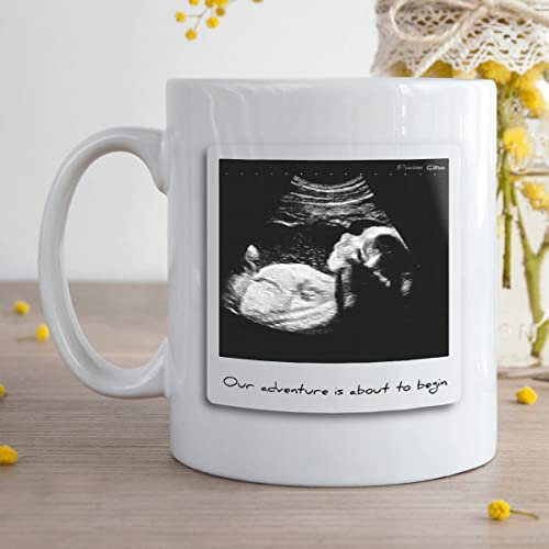 BGExpress Personalised Photo Upload Mug - Baby Scan Photo Upload Durham Mug Custom Gift for New Parent to Be, Weddings, Valentine's Day, Girl Friend, Boy Friend Coffee Cup Kitchenware