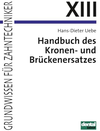 Grundwissen für Zahntechniker, Tl.13, Handbuch des Kronenersatzes und Brückenersatzes