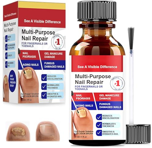 30ml Reparadores De Uñas Solución, Tratamiento De Uñas Los Pies