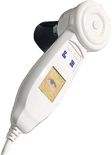 CGLYYDS IRIS-Analysekamera, hochauflösende IRIS-Kamera Pathologische Analysegeräte, Computer-Iris-Detektor, Iris-Messgerät, Iris Lupe, Iris Lupeer Iris-Software