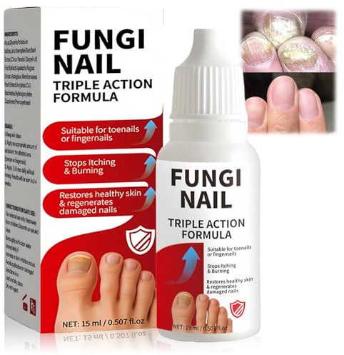 Extra Strong Fungal Nail Treatment - Nail Fungus Treatment for Toenail, Fast-Acting Formula to Repair, Strengthen & Revitalize Damaged, Discolored Toenails, Long-Lasting & Effective