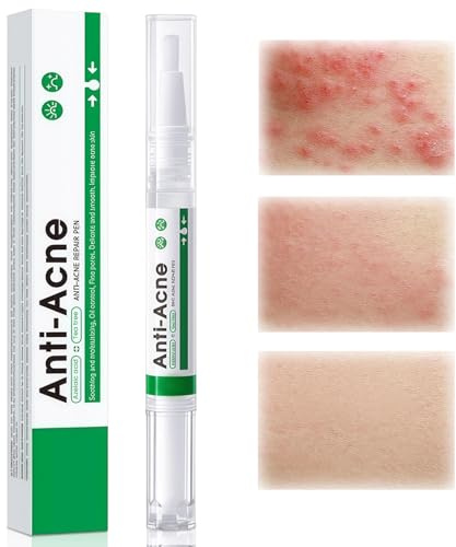 2ml Anti d'acné Soin stylo,Clear Stylo Anti-bouton,Soins pour peaux grasses Stylo,Acné visage rééquilibrant stylo,Soin localisé pour le visage,pour Peaux La plupart