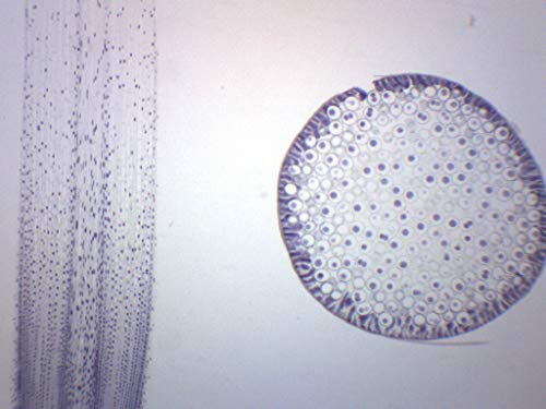EISCO Ascaris & Onion Mitosis, Prepared Microscope Slide - 75 x 25mm - Plant & Animal Mitosis, Introductory Microscopy