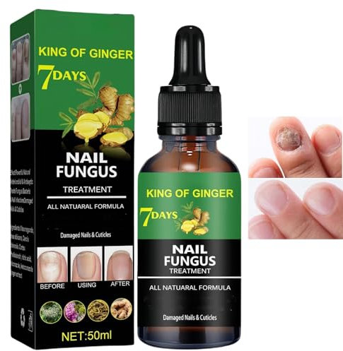 7 Days Nail Fungus Treatment,Ginger Nail Treatment,Fungal Nail Treatment,Toenail Fungus Treatment Extra Strength,Fungal Nail Treatment for Toenails Extra Strong,Nail Repair,Nail Growth Serum,50ml