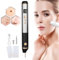 Lápiz De Plasma Láser De 15 Niveles, Elimina Manchas, Pecas, Lunares Y Verrugas, Ideal Para Labios, Manos, Ojos, Cuello, Rostro, Cabeza Y Nariz. Seguro E Indoloro, No DañA La Piel