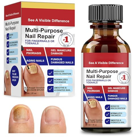 30ml Nail Treatment, Nail Recovery Serum, Toenail Strengthener, Effectively Improves the Look of Discolored, Rough Nails on Fingers and Toes, for a Restored Appearance