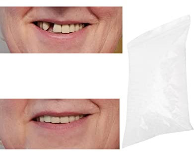 Clip en los dientes de las carillas, perlas de reparación de dientes temporales para faltar dientes rotos material de llenado dental dental, cemento de dientes (10g)