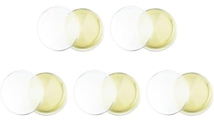 Schimmelerkennungsset, Schimmeltest-Kits für zu Hause, Agar und Kunststoff, Geeignet zur Erhaltung eines gesunden Wohnklimas, Gelb, 5 Stück