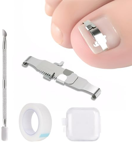 Ingrown Toenail Treatment Corrector Set, Wearable Stainless Steel Clip Buckle Ingrown Toenail Tool for Men Women Manicure and Pedicure Use Personal Care Toenail Pain Relief (S)