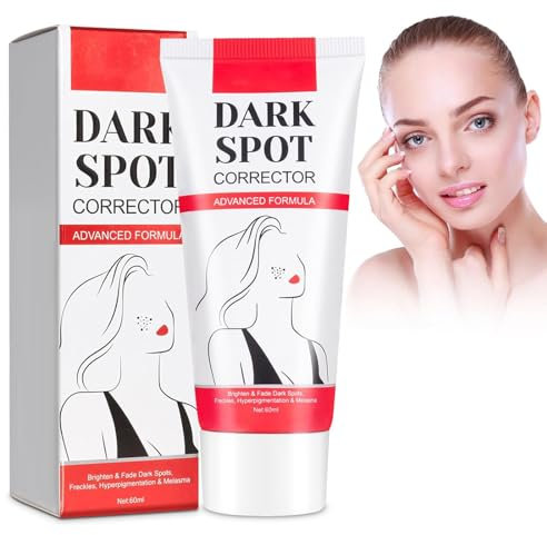 Anti Macchie Crema,Schiarente Viso,Anti-Lentiggini,Crema Per La Rimozione Delle Macchie Scure Crema Smacchiatore Per Macchie Scure,Riduce Il Melasma,Le Lentiggini e Le Macchie Solari (RED, S)