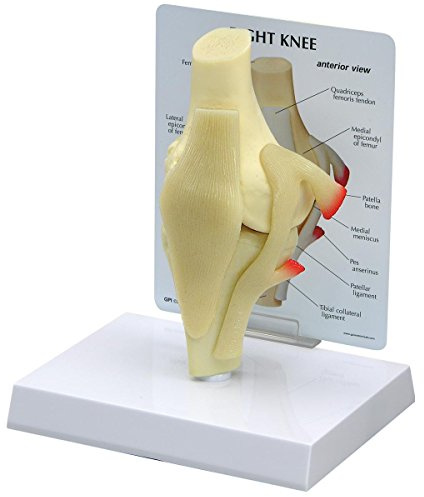 GPI Anatomicals 1000 Einfaches Kniemodell