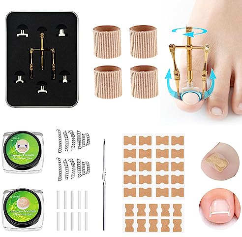 Juego Herramientas Para Uñas Encarnadas, Parche Corrector de Uñas Encarnadas, Herramientas Portátiles Para Levantar Y Protectores De Uñas, Kit de Eliminación de Uñas Encarnadas