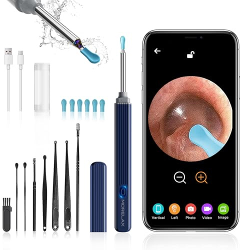 Ohrenschmalz-Entferner, Morelax 1080P WiFi-Ohrenreiniger, IP67 wasserdichtes Otoskop mit 360°-Kamera, Ohrendoskop mit 6 LEDs für iPhone, Android, iPad, Erwachsene, Kinder und Haustiere (Azurblau)