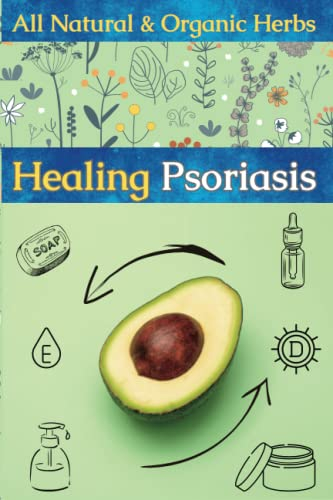 Healing Psoriasis: Psoriasis Book | Flaky Scalp Treatment