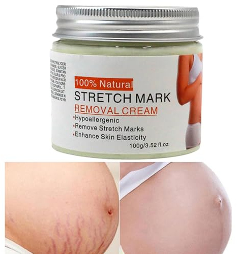 Belly Mark Cream, 100 g Dehnungsstreifen-Lotion, schnell einziehende Glättungslösung, feuchtigkeitsspendende Schwangerschaft, für Reisen, Geschäftsreisen, Zuhause, den täglichen Gebrauch, drinnen und