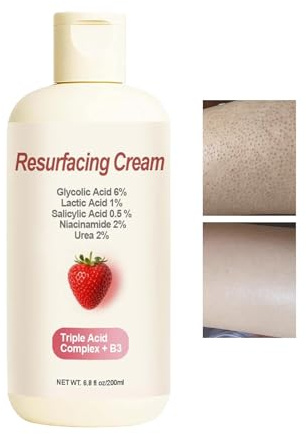 Crema para el cuidado de la piel de fresa, 200 ml removedor de piel de pollo, crema hidratante para la cara, loción corporal suavizante, perfecta para el cuidado diario del cuerpo, brazos, piernas