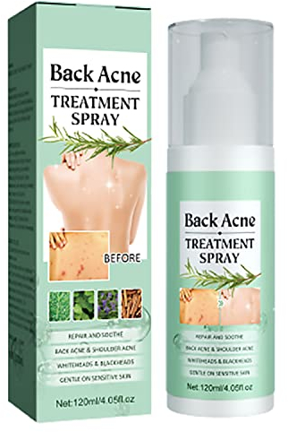 Toxiklenz Rücken-Akne-Behandlungsspray, Herbaluxy Back Acne - Spray zur Behandlung von Rückenakne, Körper-Akne-Spray, für Tiefenreinigung aller Körperteile, Sanft zur Haut (1pcs)
