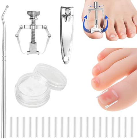 50 tiras alisadoras de uñas indoloras + corrector de uñas encarnadas, kit corrector de uñas encarnadas, levanta uñas, kit de herramientas para uñas fácil de usar